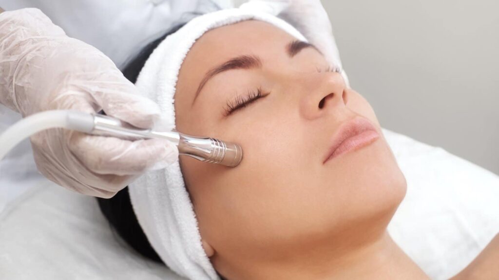 Microdermabrasion: Smoother, Younger-Looking Skin